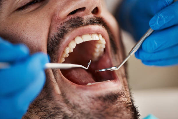 Best Emergency Treatment for Toothache in Sughter, LA