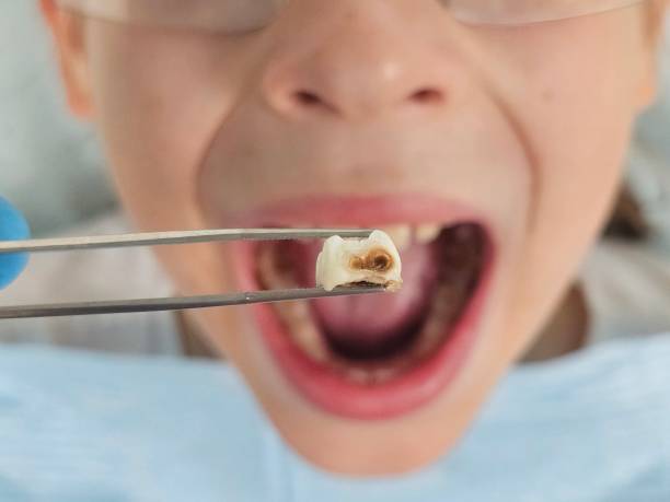 Best Walk-In Emergency Dentist in Sughter, LA