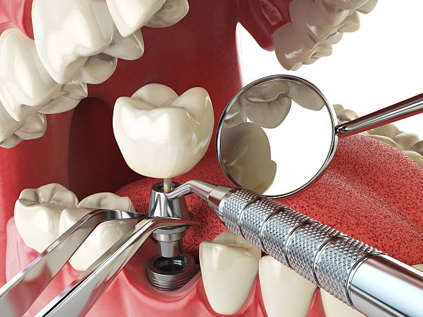 Best Emergency Dental Surgery in Sughter, LA