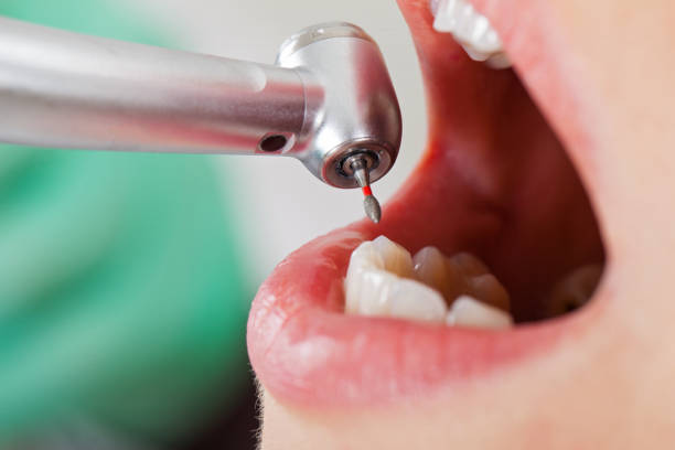 Best Emergency Tooth Extraction in Sughter, LA
